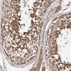 Invitrogen RNF19A Polyclonal Antibody 100 &mu;L; Unconjugated:Antibodies,