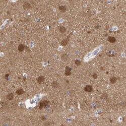 Invitrogen NCDN Polyclonal Antibody 100 &mu;L; Unconjugated:Antibodies,