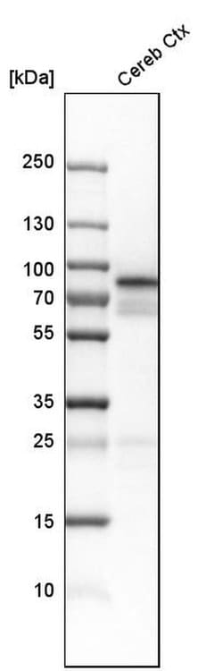Invitrogen NCDN Polyclonal Antibody 100 &mu;L; Unconjugated:Antibodies,