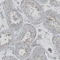 Invitrogen FBF1 Polyclonal Antibody 100 &mu;L | Buy Online | Invitrogen&trade; | Fisher Scientific