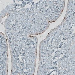 Invitrogen FBF1 Polyclonal Antibody 100 &mu;L | Buy Online | Invitrogen&trade; | Fisher Scientific