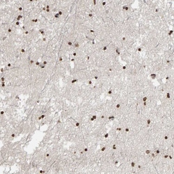 Invitrogen AFF4 Polyclonal Antibody 100 &mu;L; Unconjugated:Antibodies,