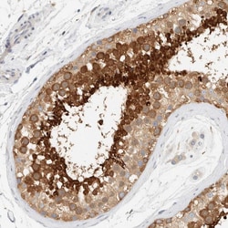 Invitrogen AARSD1 Polyclonal Antibody 100 &mu;L; Unconjugated:Antibodies,