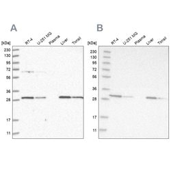 Invitrogen PROSC Polyclonal Antibody 100 &mu;L | Buy Online | Invitrogen&trade; | Fisher Scientific