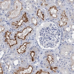 Invitrogen SLC34A3 Polyclonal Antibody 100 &mu;L; Unconjugated:Antibodies,