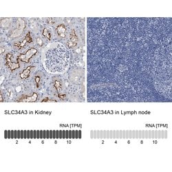 Invitrogen SLC34A3 Polyclonal Antibody 100 &mu;L; Unconjugated:Antibodies,