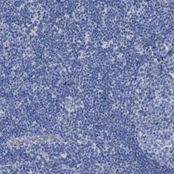 Invitrogen SLC34A3 Polyclonal Antibody 100 &mu;L; Unconjugated:Antibodies,