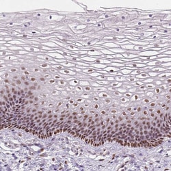 Invitrogen C1orf112 Polyclonal Antibody 100 &mu;L; Unconjugated:Antibodies,