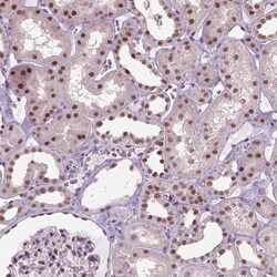 Invitrogen C1orf112 Polyclonal Antibody 100 &mu;L; Unconjugated:Antibodies,