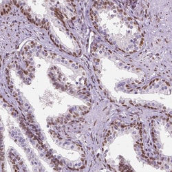 Invitrogen C1orf112 Polyclonal Antibody 100 &mu;L; Unconjugated:Antibodies,