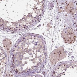 Invitrogen C1orf112 Polyclonal Antibody 100 &mu;L; Unconjugated:Antibodies,