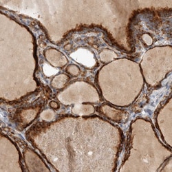 Invitrogen ADPRM Polyclonal Antibody 100 &mu;L; Unconjugated:Antibodies,