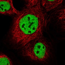 Invitrogen IBTK Polyclonal Antibody 100 &mu;L; Unconjugated:Antibodies,