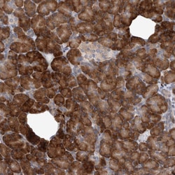 Invitrogen IBTK Polyclonal Antibody 100 &mu;L; Unconjugated:Antibodies,