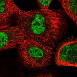 Invitrogen CDR2 Polyclonal Antibody 100 &mu;L; Unconjugated:Antibodies,