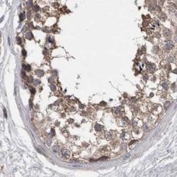 Invitrogen EPLIN Polyclonal Antibody 100 &mu;L; Unconjugated:Antibodies,