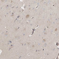 Invitrogen C9orf72 Polyclonal Antibody 100 &mu;L; Unconjugated:Antibodies,