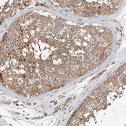 Invitrogen C9orf72 Polyclonal Antibody 100 &mu;L; Unconjugated:Antibodies,