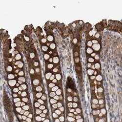 Invitrogen C9orf72 Polyclonal Antibody 100 &mu;L; Unconjugated:Antibodies,