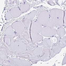 Invitrogen PAGE4 Polyclonal Antibody 100 &mu;L; Unconjugated:Antibodies,