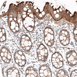 Invitrogen FAT1 Polyclonal Antibody 100 &mu;L; Unconjugated:Antibodies,