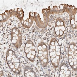 Invitrogen FAT1 Polyclonal Antibody 100 &mu;L; Unconjugated:Antibodies,