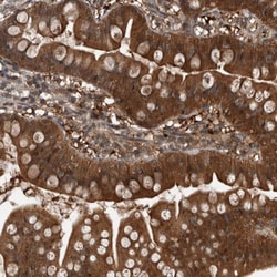 Invitrogen MYO1E Polyclonal Antibody 100 &mu;L; Unconjugated:Antibodies,