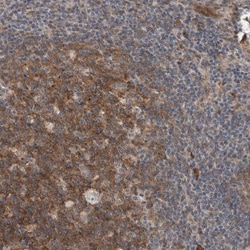 Invitrogen MYO1E Polyclonal Antibody 100 &mu;L; Unconjugated:Antibodies,