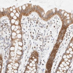 PPM1K Polyclonal Antibody, Invitrogen 100 &mu;L | Buy Online | Invitrogen | Fisher Scientific