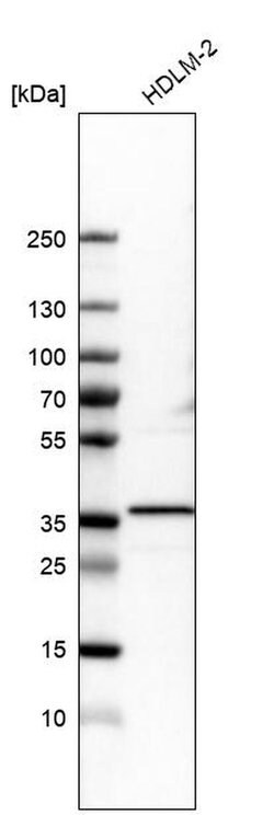 PPM1K Polyclonal Antibody, Invitrogen 100 &mu;L | Buy Online | Invitrogen | Fisher Scientific