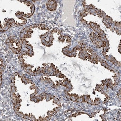 Invitrogen FAM78A Polyclonal Antibody 100 &mu;L; Unconjugated:Antibodies,