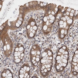 Invitrogen GSDMB Polyclonal Antibody 100 &mu;L; Unconjugated:Antibodies,