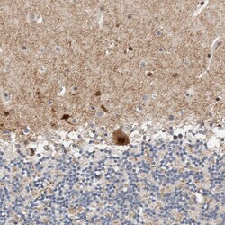 Invitrogen ZNF703 Polyclonal Antibody 100 &mu;L | Buy Online | Invitrogen&trade; | Fisher Scientific