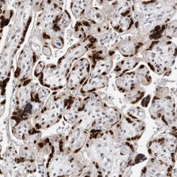 Invitrogen ZNF703 Polyclonal Antibody 100 &mu;L | Buy Online | Invitrogen&trade; | Fisher Scientific