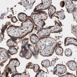 Invitrogen VCPIP1 Polyclonal Antibody 100 &mu;L; Unconjugated:Antibodies,