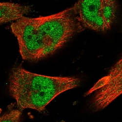 Invitrogen ZNF567 Polyclonal Antibody 100 &mu;L; Unconjugated:Antibodies,