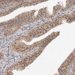 Invitrogen ZNF567 Polyclonal Antibody 100 &mu;L; Unconjugated:Antibodies,