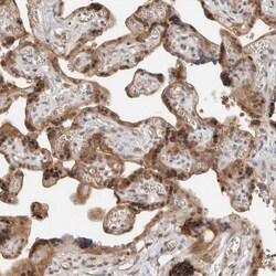 Invitrogen ZNF567 Polyclonal Antibody 100 &mu;L; Unconjugated:Antibodies,