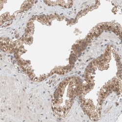 Invitrogen ZNF567 Polyclonal Antibody 100 &mu;L; Unconjugated:Antibodies,