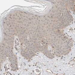 Invitrogen ZNF567 Polyclonal Antibody 100 &mu;L; Unconjugated:Antibodies,