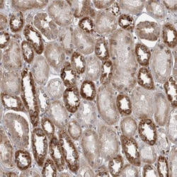 Invitrogen C17orf70 Polyclonal Antibody 100 &mu;L; Unconjugated:Antikörper