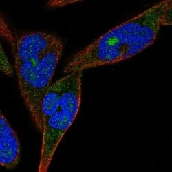Invitrogen ZNF583 Polyclonal Antibody 100 &mu;L; Unconjugated:Antibodies,