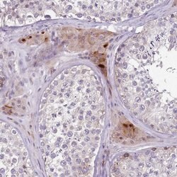 Invitrogen ZNF583 Polyclonal Antibody 100 &mu;L; Unconjugated:Antibodies,