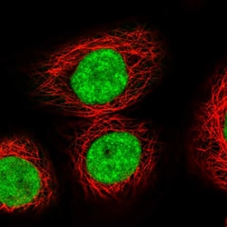 Invitrogen XPO5 Polyclonal Antibody 100 &mu;L; Unconjugated:Anticuerpos