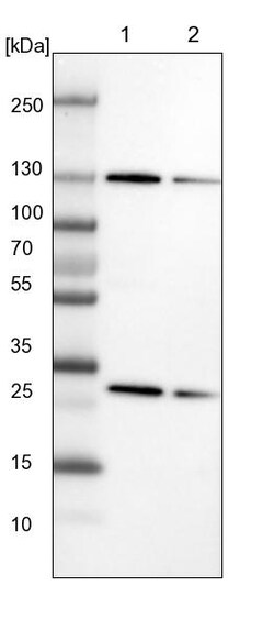 Invitrogen XPO5 Polyclonal Antibody 100 &mu;L; Unconjugated:Anticuerpos