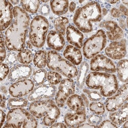 Invitrogen DHRS4 Polyclonal Antibody 100 &mu;L; Unconjugated:Antibodies,
