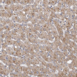 Invitrogen DHRS4 Polyclonal Antibody 100 &mu;L; Unconjugated:Antibodies,