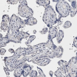 Invitrogen DHRS4 Polyclonal Antibody 100 &mu;L; Unconjugated:Antibodies,