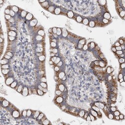 Invitrogen DHRS4 Polyclonal Antibody 100 &mu;L; Unconjugated:Antibodies,