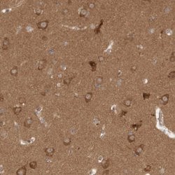 Invitrogen WIPF2 Polyclonal Antibody 100 &mu;L; Unconjugated:Antikörper